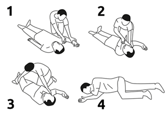 A diagram depicting the recovery position.