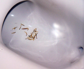Moth fly larva in toilet