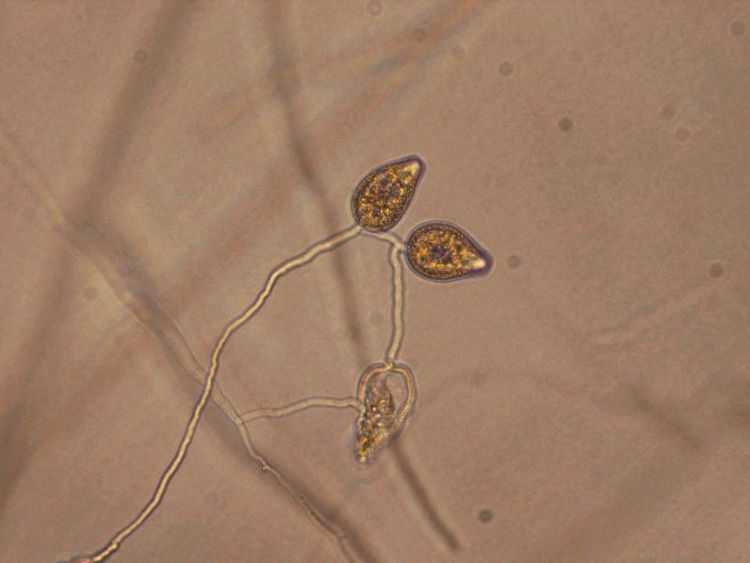Photo 1. Phytophthora sporangia from infected calibrachoa. All images courtesy of Mary Hausbeck, MSU.