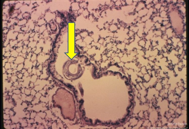 Protect your pigs from verminous pneumonia   Pork