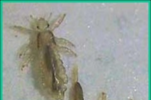 Headlice Plant Pest Diagnostics
