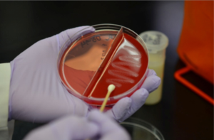 Advances in understanding Gram-positive mastitis on farms