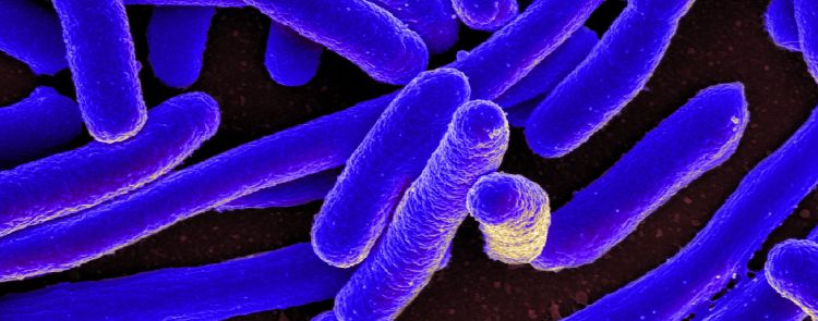 A picture of E. coli