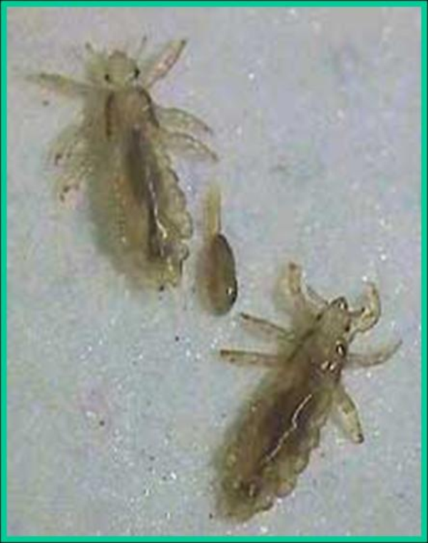 head lice