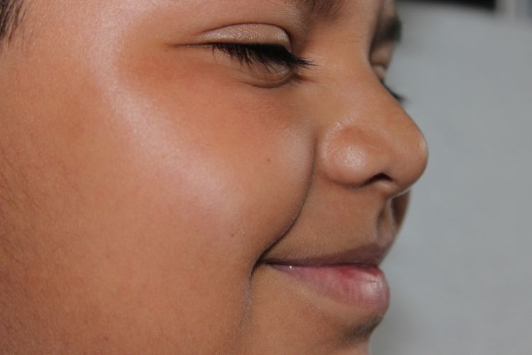 Closeup of a boy's face