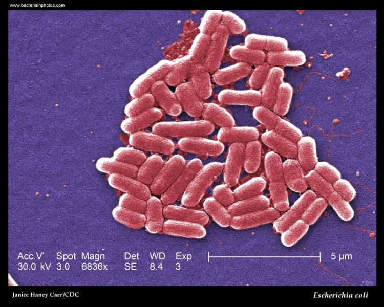 “The Big 6” foodborne pathogens E. coli MSU Extension