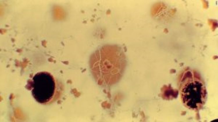 Up close and personal with some Aspergillus from the slide show in the article.