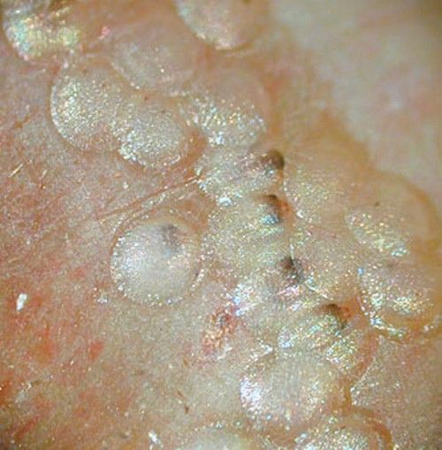 Grape berry moth eggs.