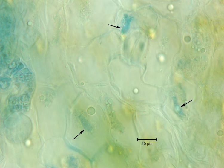 Haustoria inside the cells of a dandelion leaf.