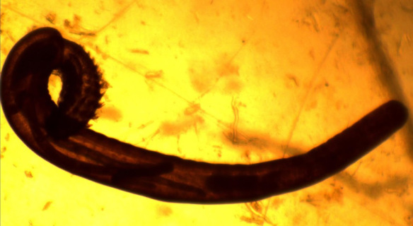 Acanthocephala worm under a microscope