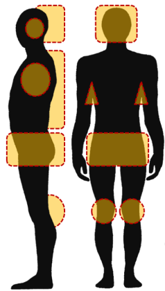 Common tick bite areas.