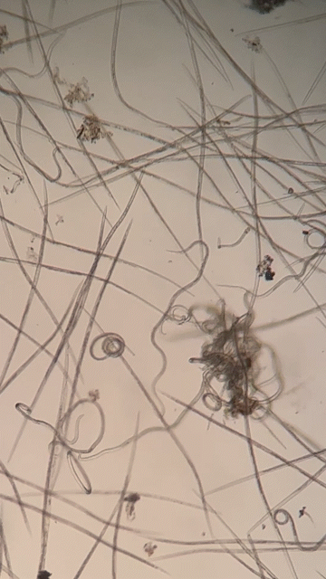 The causal agent of beech leaf disease at 200x magnification.