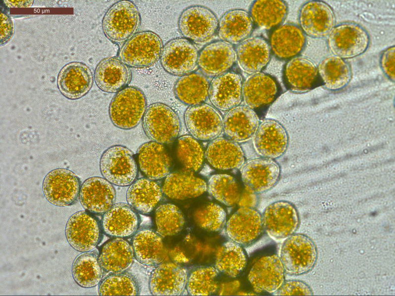 Urediniospores 