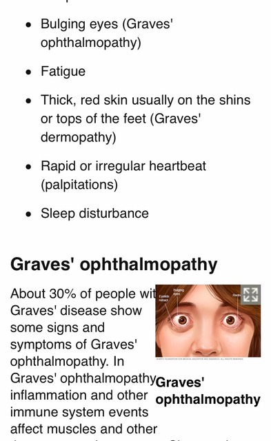 Graves' ophthalmopathy