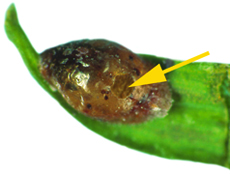 Fletcher scale