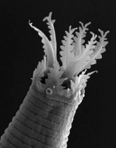 Scanning electron micrograph of a bacterial-feeding nematode