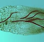 Nematodes in Home Gardens and Landscapes