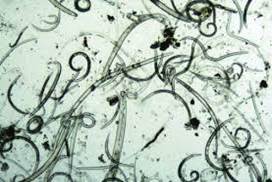 Assorted nematodes under a microscope 