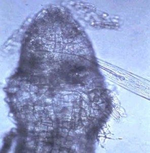 Dagger nematode feeding on a root tip