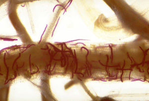 lance nematodes stained in root tissue