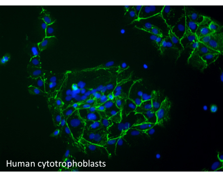 human cyto