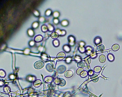 spores spores