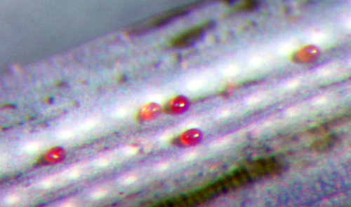 Eriophyid mite eggs Eriophyid mite eggs