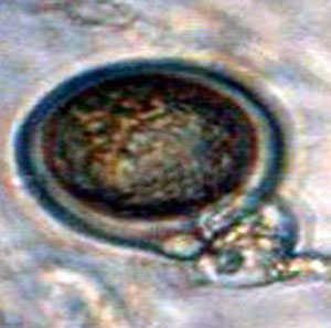 Phytophthora Phytophthora