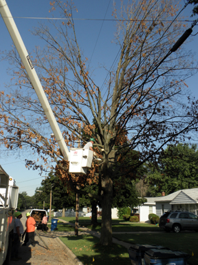 limb removal