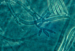 Fusarium root rot