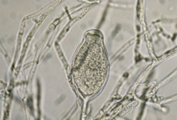 Phytophthora asexual spore