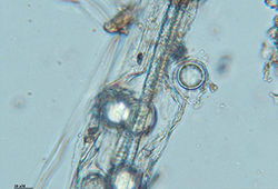 Pythium spore