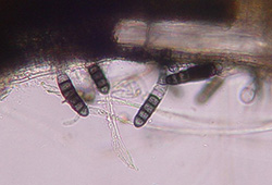 Thielaviopsis spores